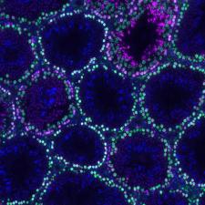 New Research Sheds Light on Causes of Reproductive Disorders, Infertility, Miscarriage, Birth Defects